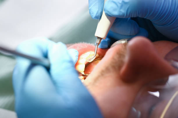 Best Teeth Whitening  in Plainwell, MI