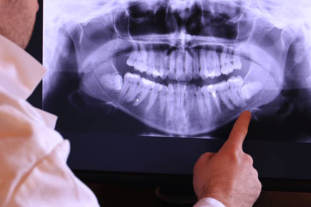 Best Emergency Gum Pain Relief  in Plainwell, MI